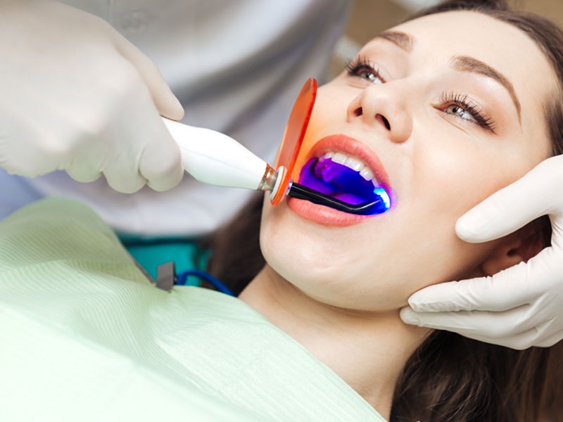 Dịch vụ tẩy trắng răng cao cấp, chất lượng tại phòng răng 108 Dr. Chiến