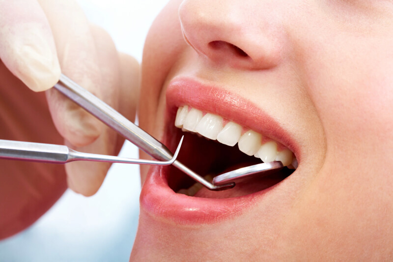 Nhổ răng khôn có đau không? Những lưu ý trong quá trình nhổ răng khôn