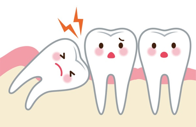Mách bạn những cách giảm đau khi mọc răng khôn hiệu quả