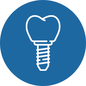 Dịch vụ trồng răng implant không đau, an toàn tại phòng