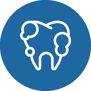 Dịch vụ lấy cao răng uy tín, chất lượng tại phòng răng 